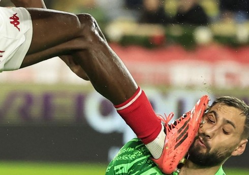 Fransa klubunun müdafiəçisi zədələdiyi rəqibindən üzr istəyib